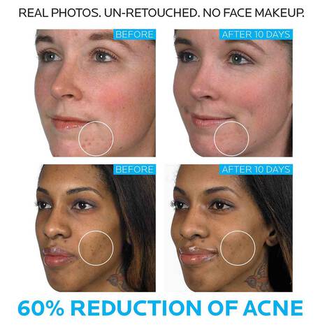 La Roche Posay - Effaclair DUO+