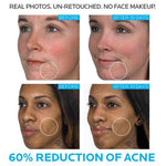 La Roche Posay - Effaclair DUO+